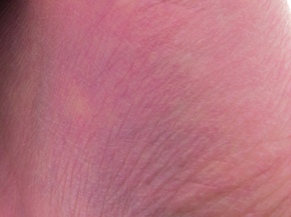 NORDIC NRF6936 for sale